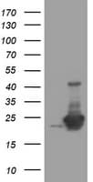 UBE2E3 Antibody (clone OTI1C3)