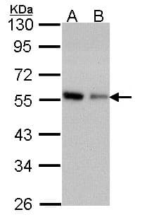 Polyclonal Rabbit anti-Human CORO1C Antibody (aa411-474, IHC, WB)