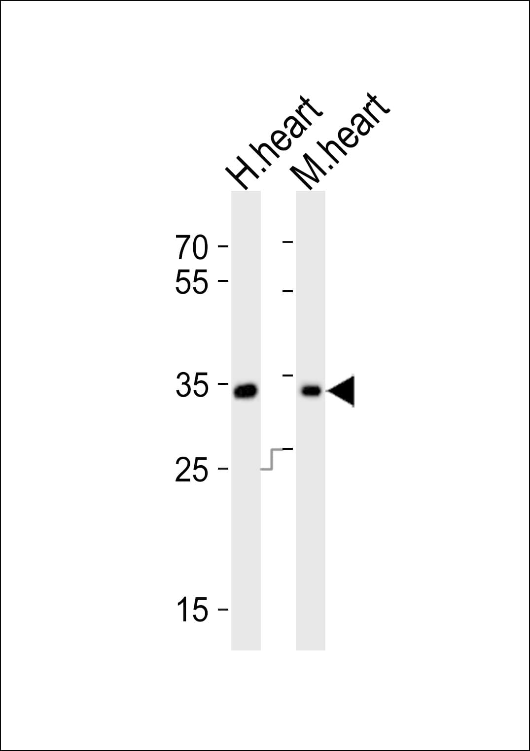 Polyclonal Rabbit anti-Human ASB11 Antibody (aa26-54, WB)
