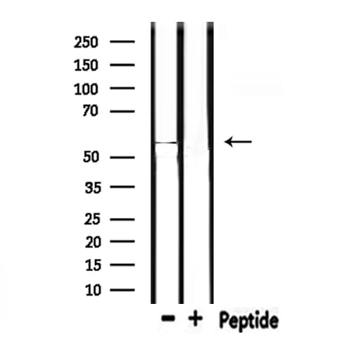 MMP10 Antibody