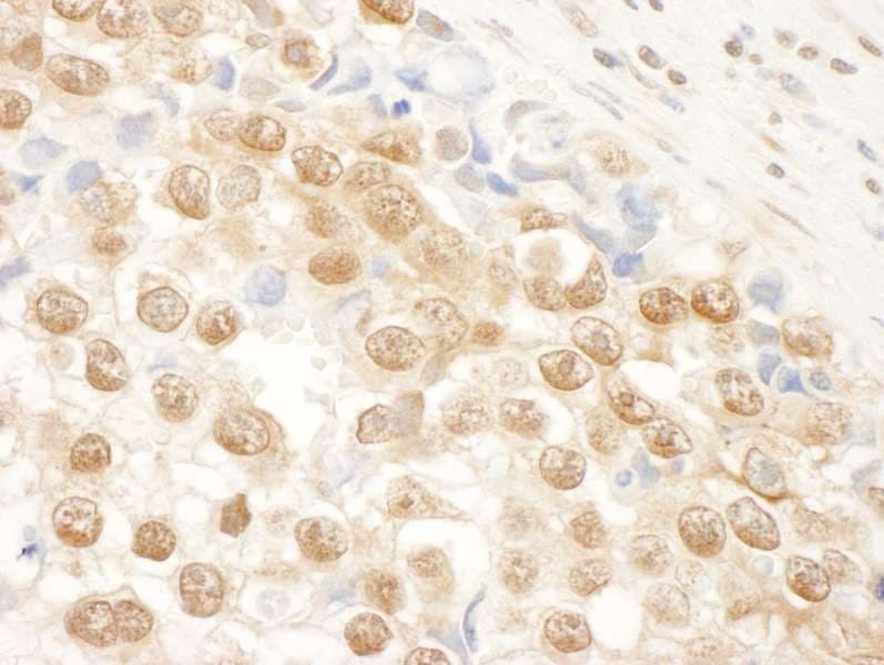 Polyclonal Rabbit anti-Human NARG1 / NAA15 Antibody (aa816-866, IHC)