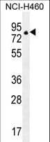 Polyclonal Rabbit anti-Human ZNF28 Antibody (aa87-115, WB)