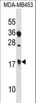 Polyclonal Rabbit anti-Human SIT1 Antibody (aa161-189, WB)