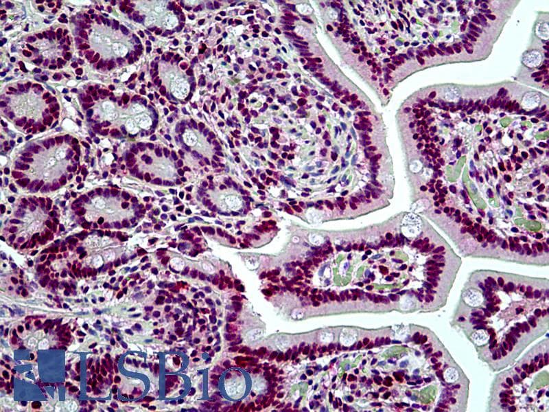 PathPlus™ SMARCA4 / BRG1 Antibody (aa2-14)