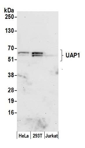 Polyclonal Rabbit anti-Human UAP1 Antibody (aa1-50, WB)