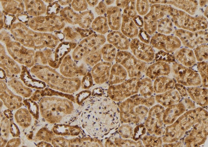 RGS10 Antibody