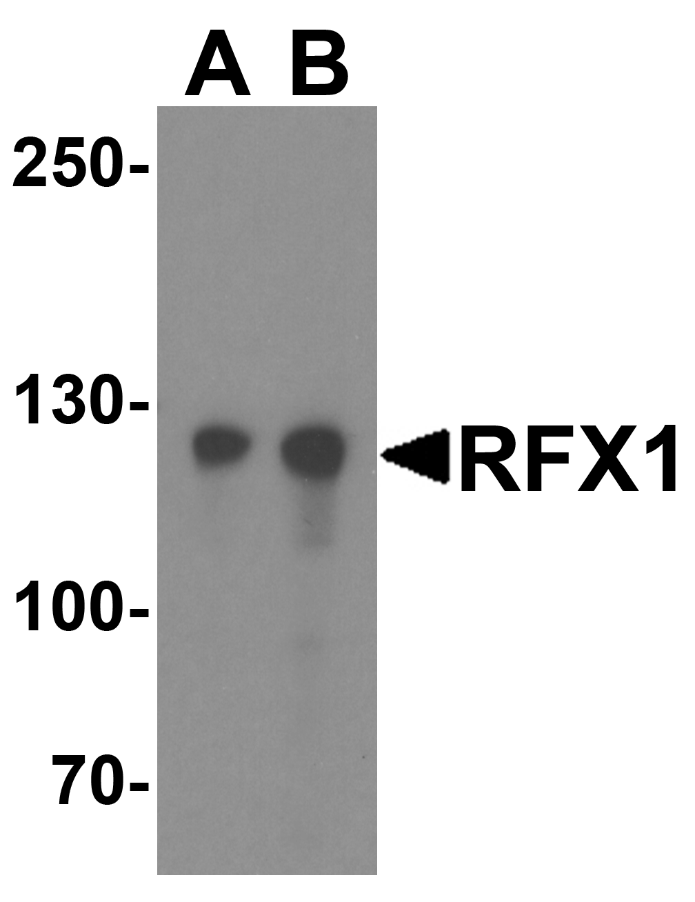 IHC-plus™ Polyclonal Rabbit anti-Human RFX / RFX1 Antibody (IHC, IF, WB)
