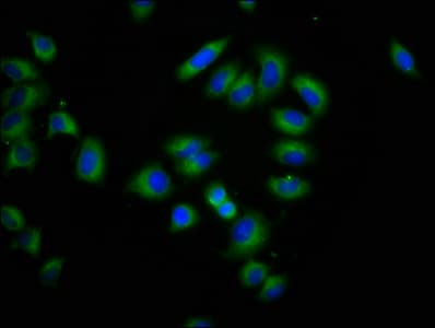 Polyclonal Rabbit anti-Human CLPTM1L / CLPTM1-Like Antibody (IHC, IF, WB)