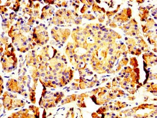 PNLIP / PL / Pancreatic Lipase Antibody