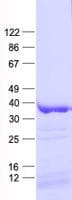 Human CSNK1A1L Protein (Recombinant His, N-Terminal)