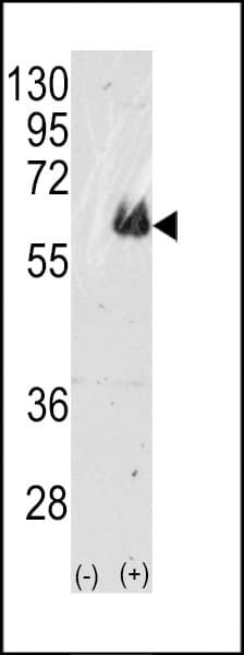Polyclonal Rabbit anti-Human MAPT / Tau Antibody (aa677-707, IHC, IF, WB)