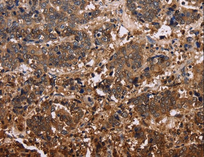 Polyclonal Rabbit anti-Human FBP2 Antibody (IHC)