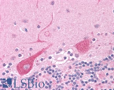 PathPlus™ NEK6 Antibody (C-Terminus)