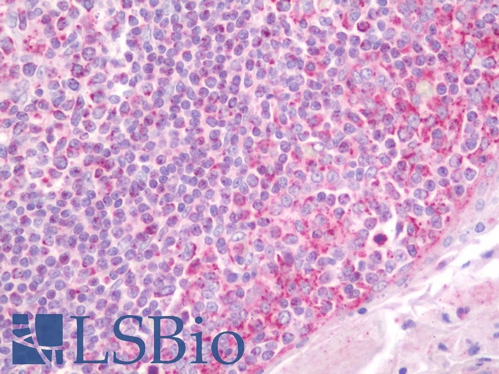 IHC-plus™ APPL1 / APPL Antibody (aa111-160)