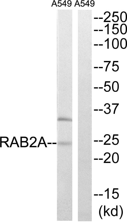 Polyclonal Rabbit anti-Human RAB2A / RAB2 Antibody (IHC, WB)