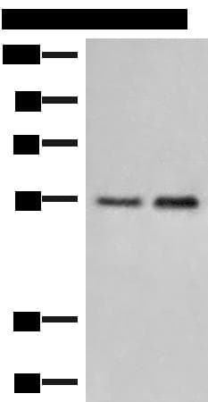Polyclonal Rabbit anti-Human HTRA4 Antibody (IHC, WB)