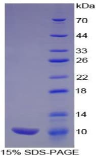 Rat CXCL7 / PPBP Protein (Recombinant His-T7)