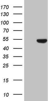 KRT16 / CK16 / Cytokeratin 16 Antibody (clone OTI1G5)