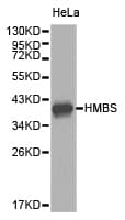 HMBS / PBGD Antibody