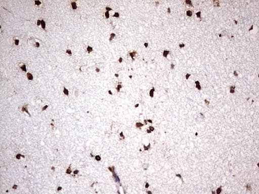 GLI / GLI1 Antibody (aa755-1106, clone OTI2E5)