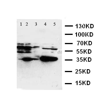 Polyclonal Rabbit anti-Human FOSB Antibody (aa1-15, WB)