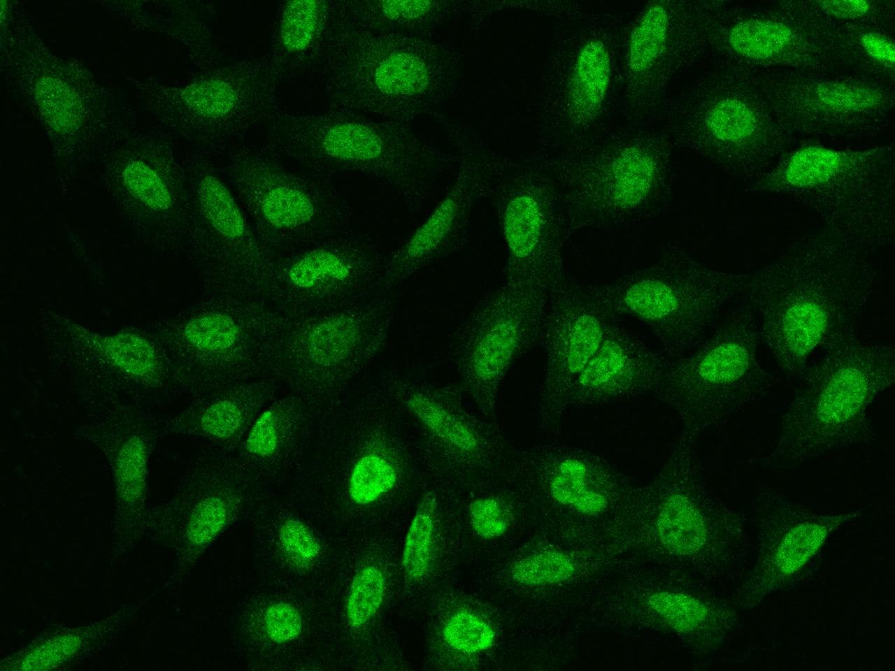 PDPK1 / PDK1 Antibody