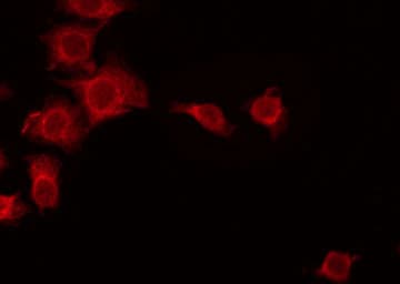 UBFD1 Antibody