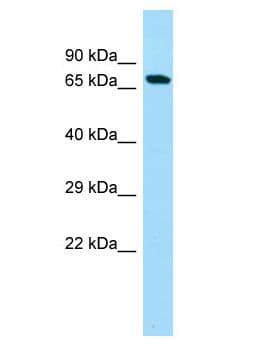 NOL4L Antibody (aa225-274)