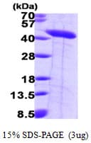 Human SEPT2 / Septin 2 Protein (Recombinant His)