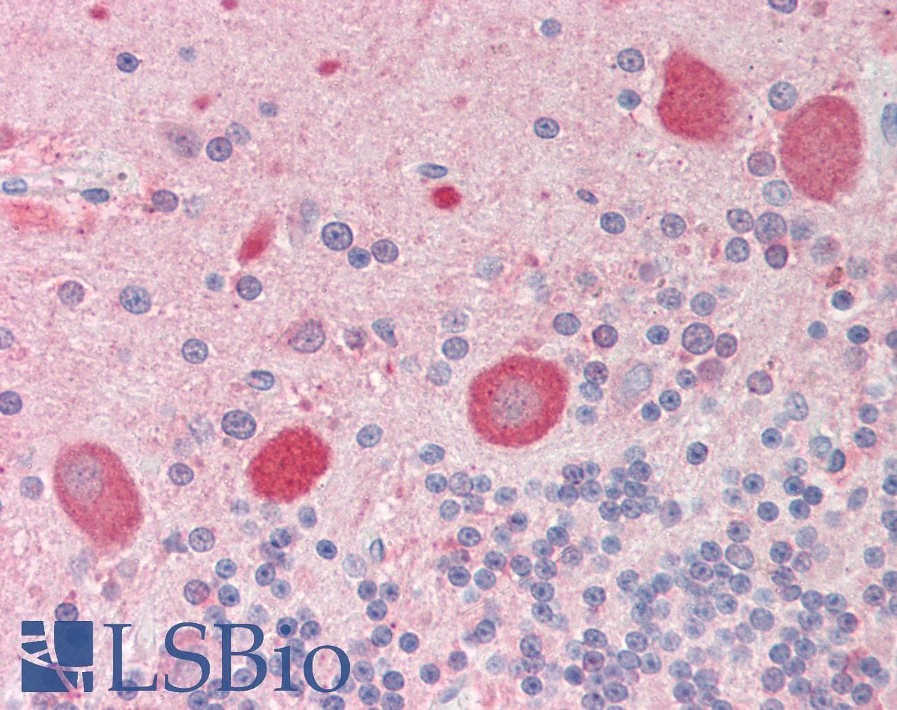 IHC-plus™ Tubulin Antibody (clone YL1/2)