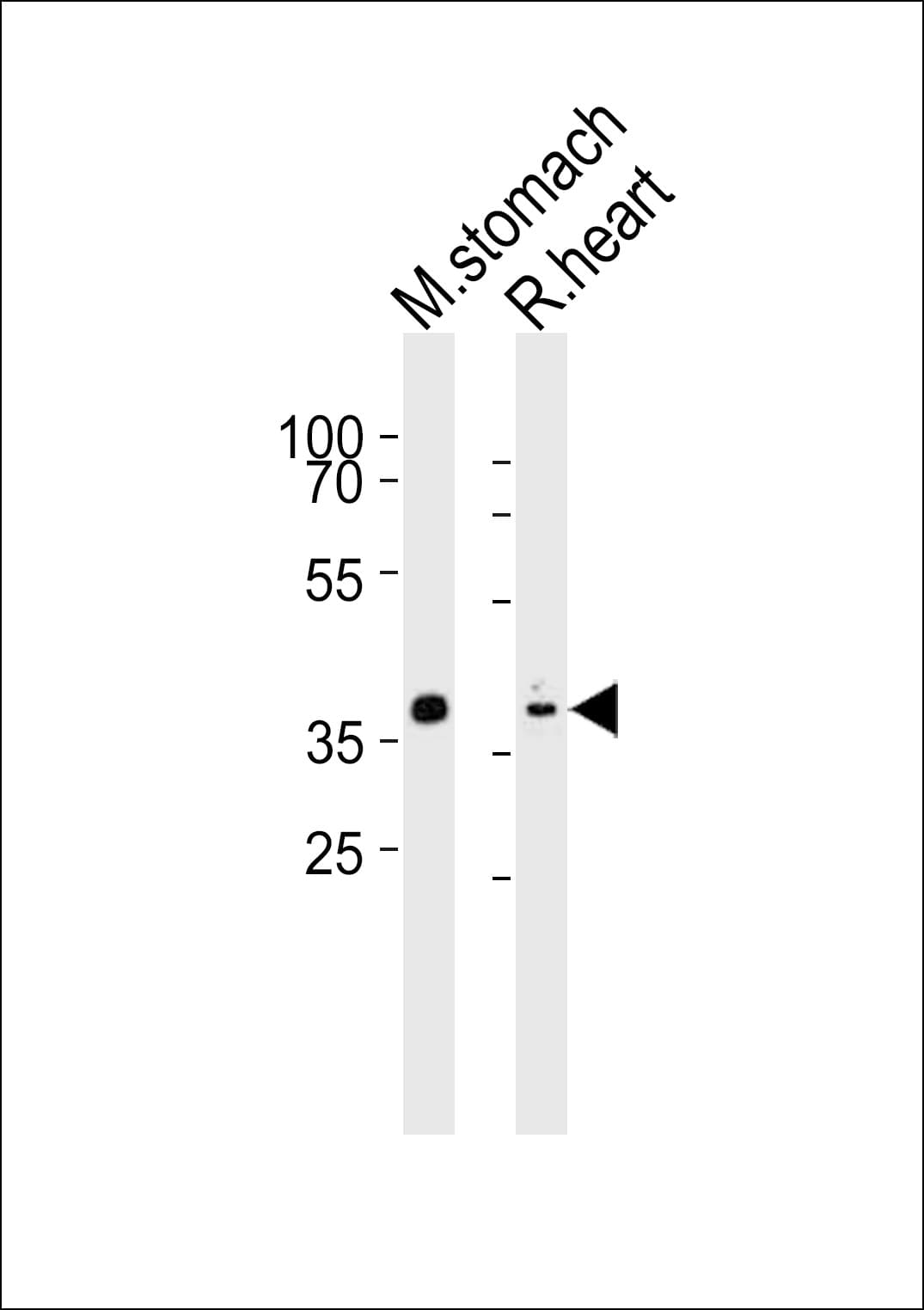 NKX2-5 Antibody (aa192-225)