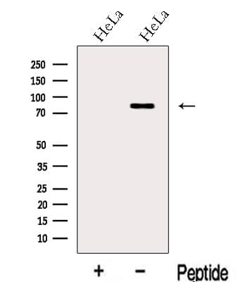 Polyclonal Rabbit anti-Human LCA5 Antibody (WB)