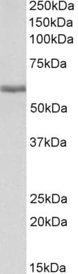 IHC-plus™ FGB / Fibrinogen Beta Chain Antibody (aa177-190)