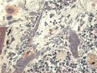 HLA-G Antibody (clone MEM-G/1)