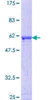 Human RAD1 Protein (Recombinant GST)