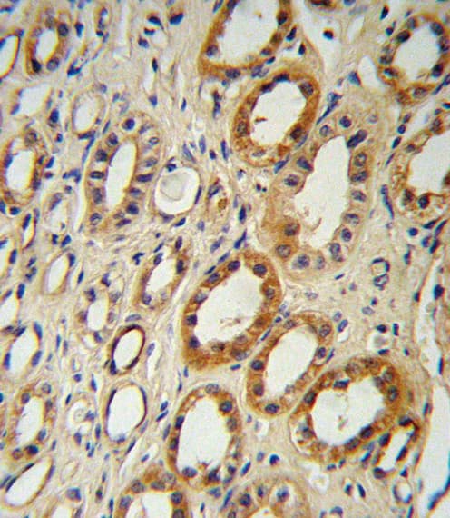 CYP27B1 Antibody (aa482-508)