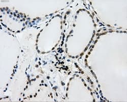 L1CAM Antibody (clone OTI3G1)