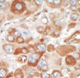 SRPK2 Antibody (aa465-495)