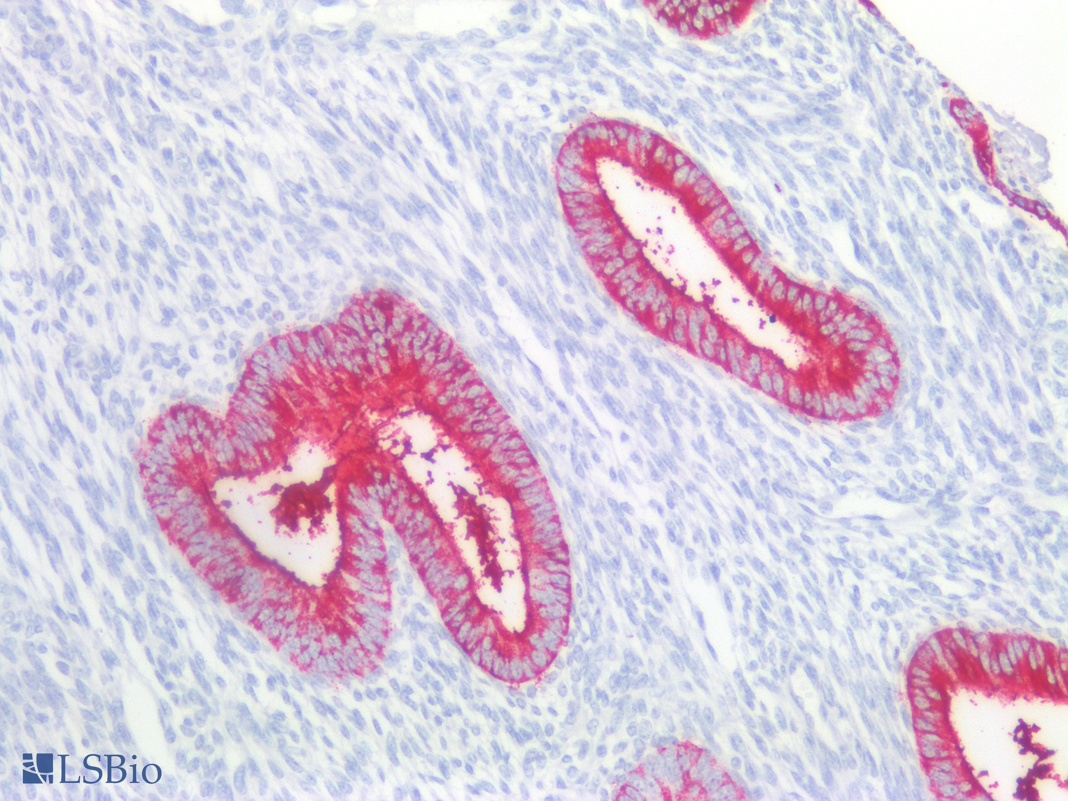 PathPlus™ FUT4 / CD15 Antibody (clone MMA)