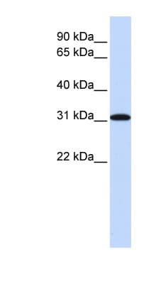 Polyclonal Rabbit anti-Human RPA4 Antibody (aa180-229, WB)