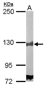 Polyclonal Rabbit anti-Human DDB1 Antibody (aa749-1140, IHC, WB)