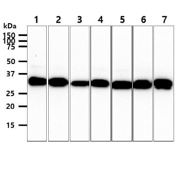 Monoclonal Mouse anti-Human CBR3 Antibody (clone AT7E8, WB)