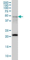 PathPlus™ FOXA2 Antibody (clone 2F12)