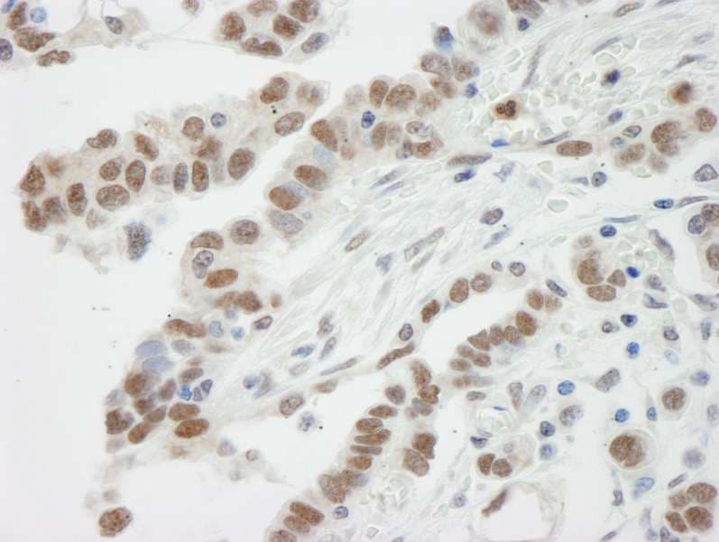 SMARCE1 / BAF57 Antibody (aa360-C-term)