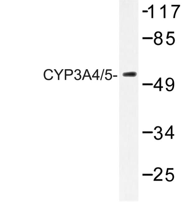 Polyclonal Rabbit anti-Human CYP3A4+5 Antibody (Phe386, IHC, IF, WB)