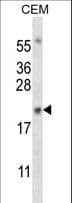 MYOG / Myogenin Antibody (aa30-58)