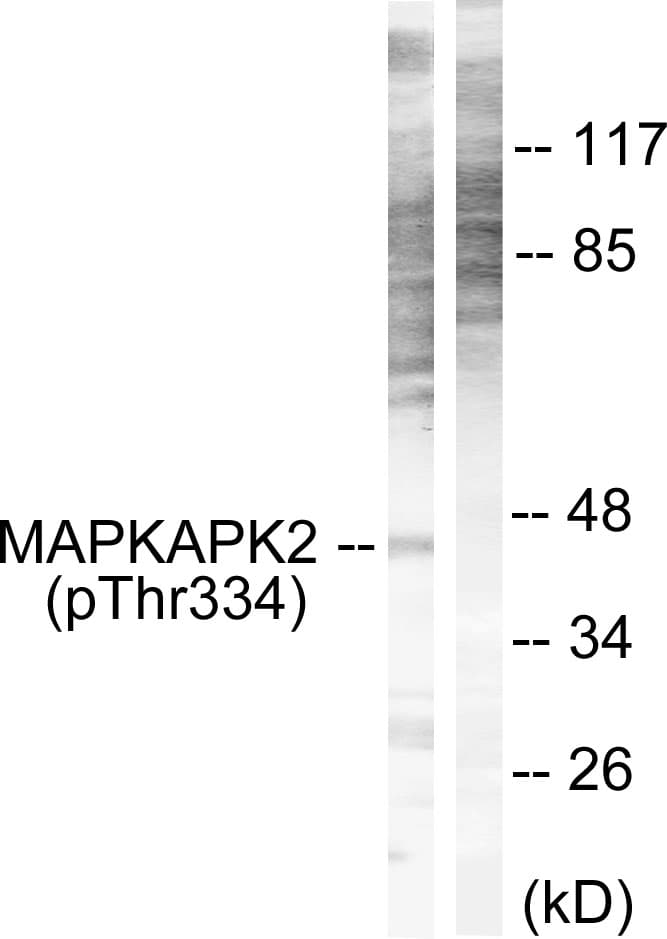 MAPKAPK2 / MAPKAP Kinase 2 Antibody (phospho-Thr334)