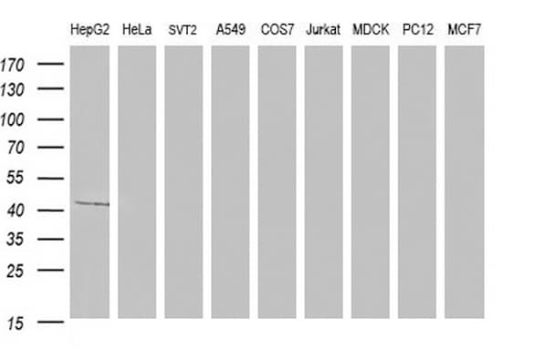 Apolipoprotein A-V Antibody (clone OTI1G4)