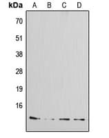 Polyclonal Rabbit anti-Human IAPP / Amylin Antibody (N-Terminus, IHC, IF, WB)