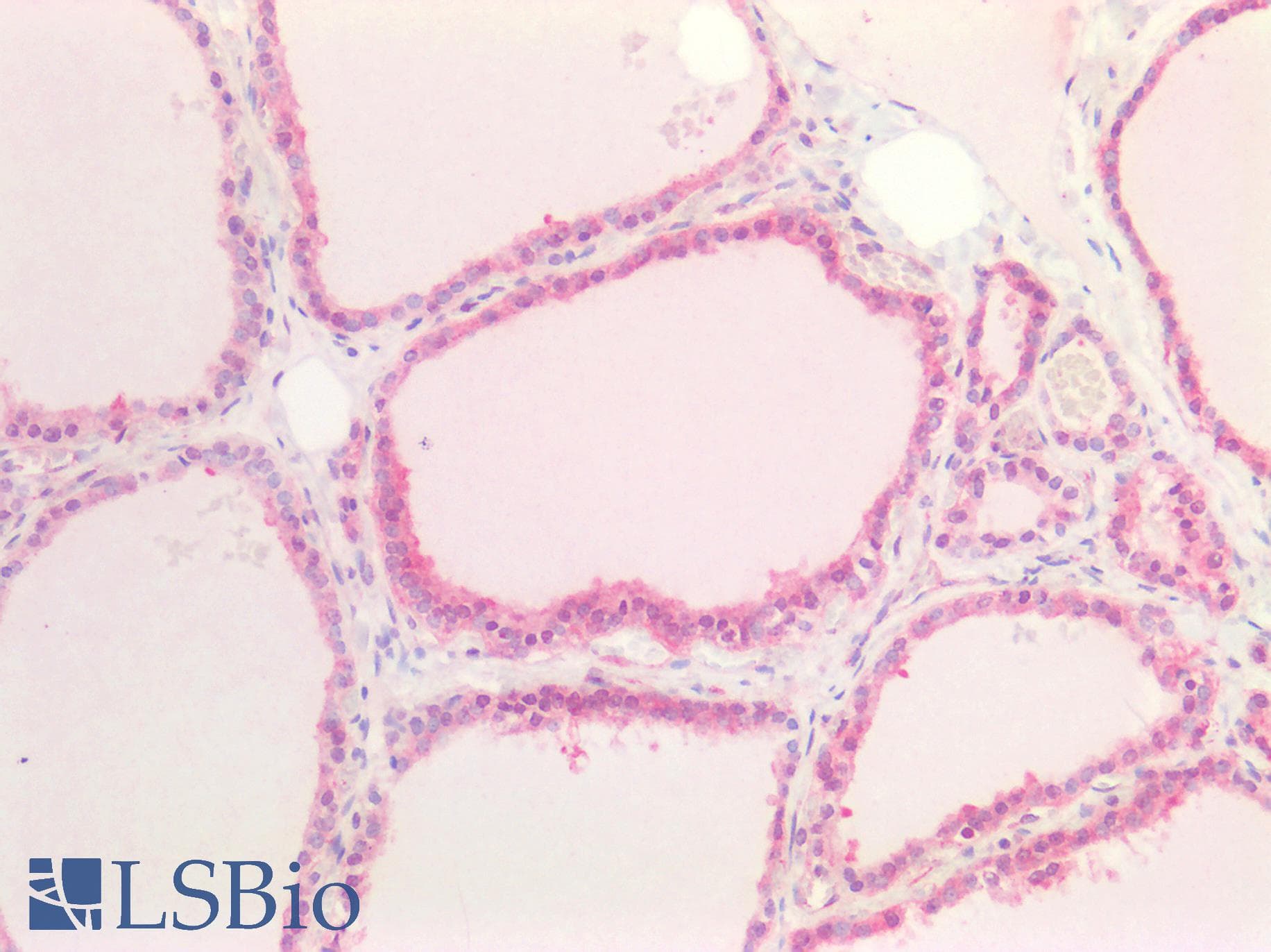 IHC-plus™ BCL2L2 / Bcl-w Antibody (aa2-193)